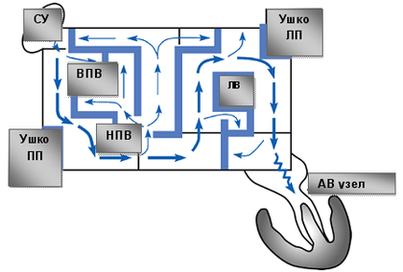 Схема операции Maze